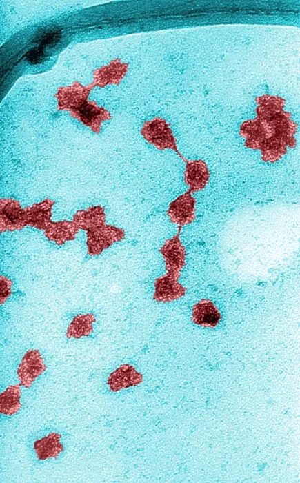 Framed Print : Genetics, Messenger RNA (mRNA), TEM Framed Print : Genetics, Messenger RNA (mRNA), TEM