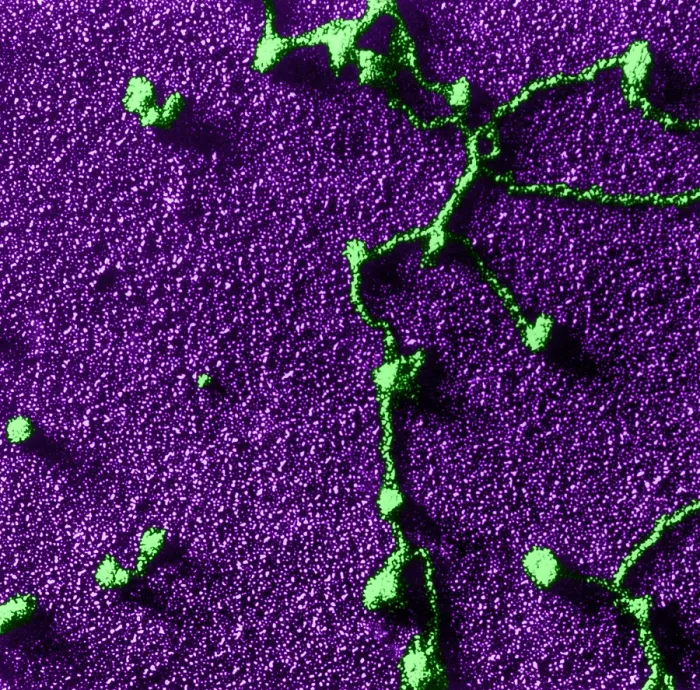 Framed Print : Genetics, RNA Attached to DNA, TEM Framed Print : Genetics, RNA Attached to DNA, TEM