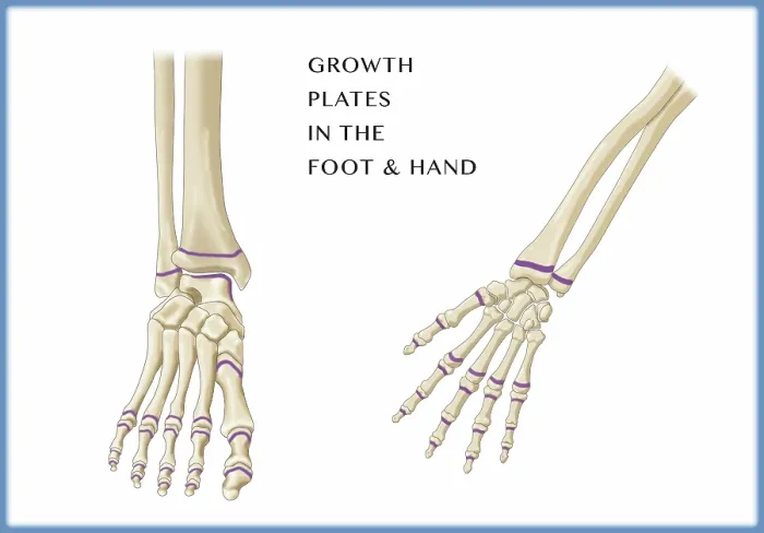 Framed Print : Growth Plates, Foot and Hand, Illustration Framed Print : Growth Plates, Foot and Hand, Illustration