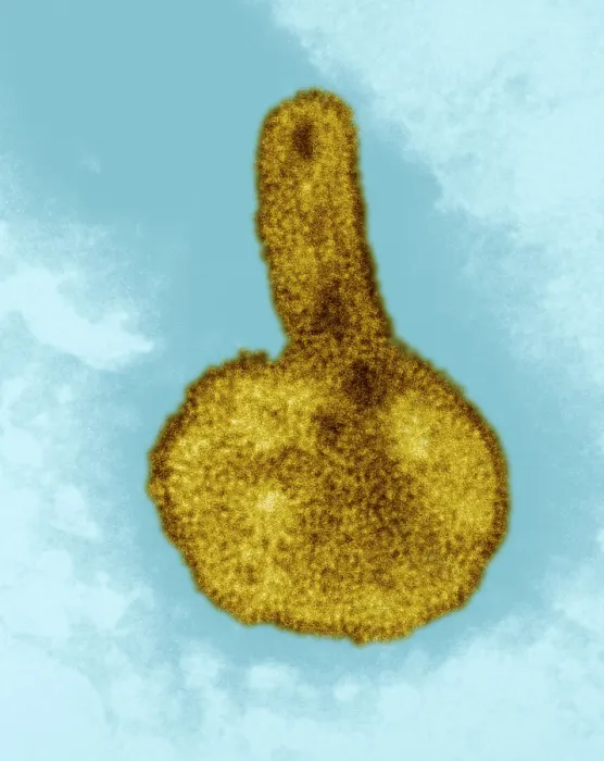 Framed Print : H3N2, Hong Kong Flu Virus, TEM Framed Print : H3N2, Hong Kong Flu Virus, TEM