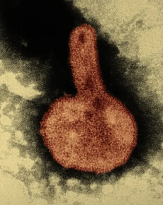 Framed Print : H3N2, Hong Kong Flu Virus, TEM Framed Print : H3N2, Hong Kong Flu Virus, TEM