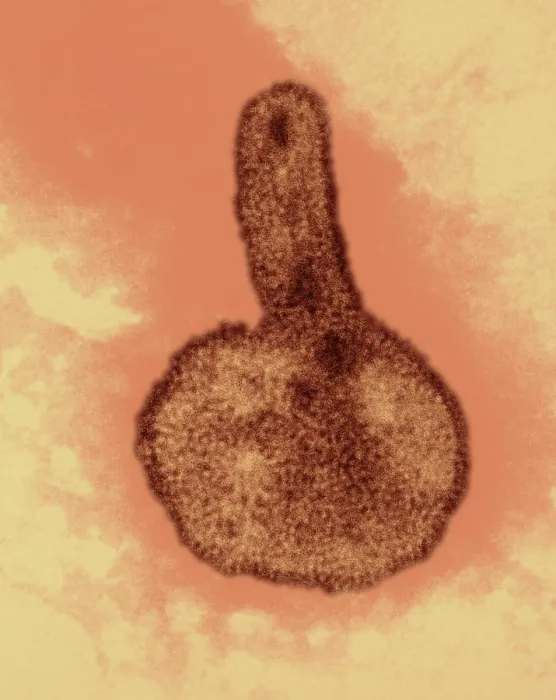 Framed Print : H3N2, Hong Kong Flu Virus, TEM