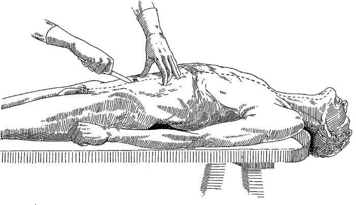 Framed Print : A Handbook of Morbid Anatomy and Post-Mortem Technique