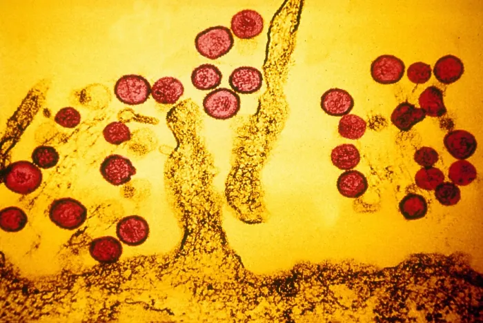 Framed Print : Hanta Virus (TEM)