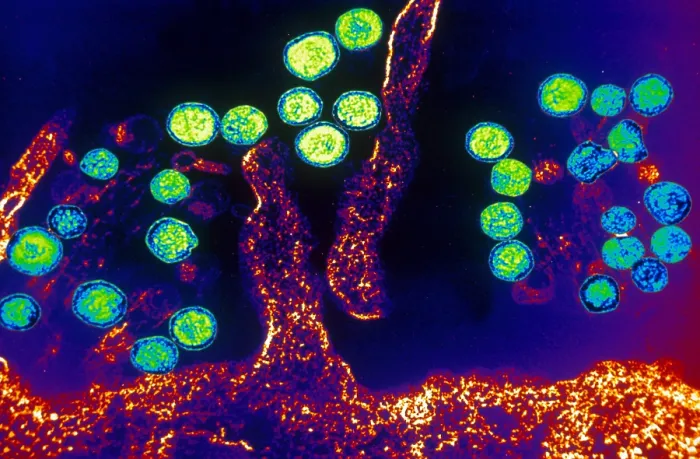 Framed Print : Hanta Virus (TEM) Framed Print : Hanta Virus (TEM)