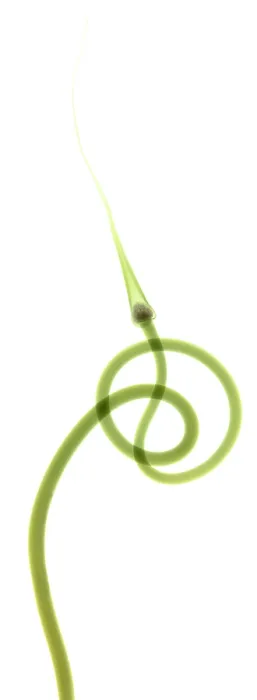 Framed Print : Hardneck Garlic Scapes, X-ray Framed Print : Hardneck Garlic Scapes, X-ray