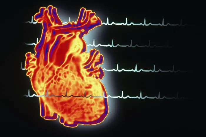 Framed Print : Healthy EKG Framed Print : Healthy EKG