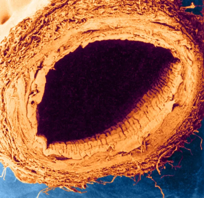 Framed Print : Healthy Vein, under a microscope (SEM) Framed Print : Healthy Vein, under a microscope (SEM)