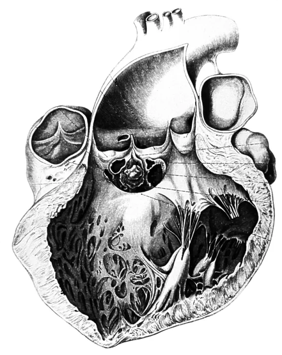 Framed Print : Heart Anatomy, Carl von Rokitansky, 1875 Framed Print : Heart Anatomy, Carl von Rokitansky, 1875