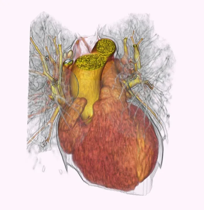 Framed Print : Heartbeat Sequence Illustration 1 Framed Print : Heartbeat Sequence Illustration 1