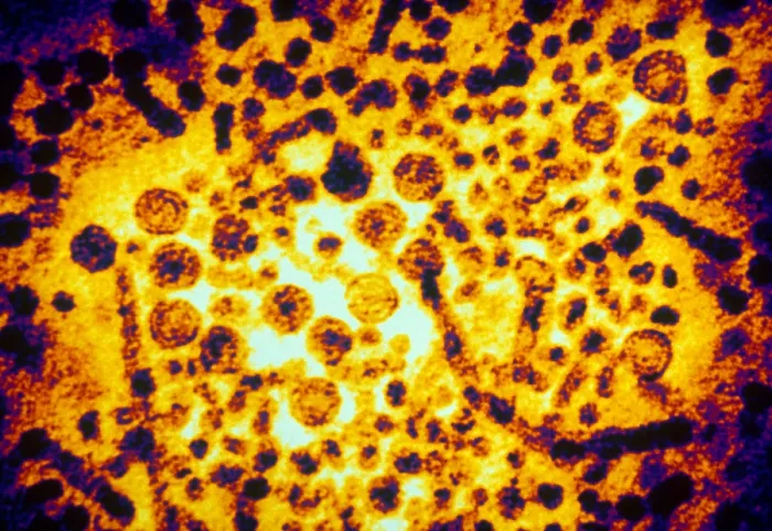 Framed Print : Hepatitis B Virus (TEM) Framed Print : Hepatitis B Virus (TEM)