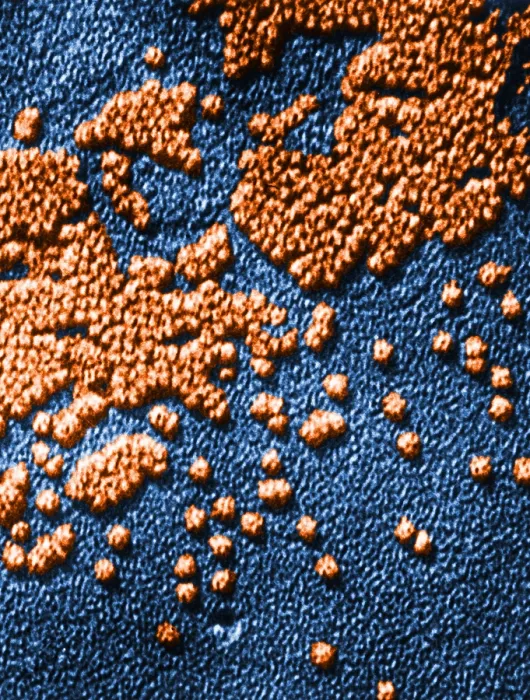 Framed Print : Hepatitis Virus Framed Print : Hepatitis Virus