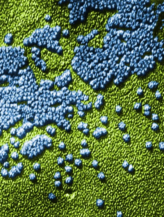 Framed Print : Hepatitis Virus