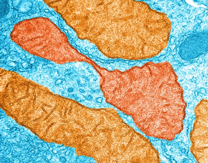 Framed Print : Hepatocyte, Dividing Mitochondrion, TEM