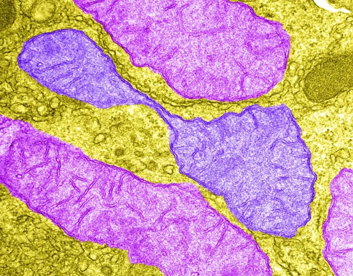 Framed Print : Hepatocyte, Dividing Mitochondrion, TEM