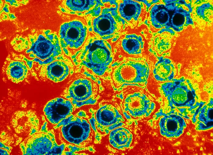 Framed Print : Herpes Simplex Virus (TEM) Framed Print : Herpes Simplex Virus (TEM)