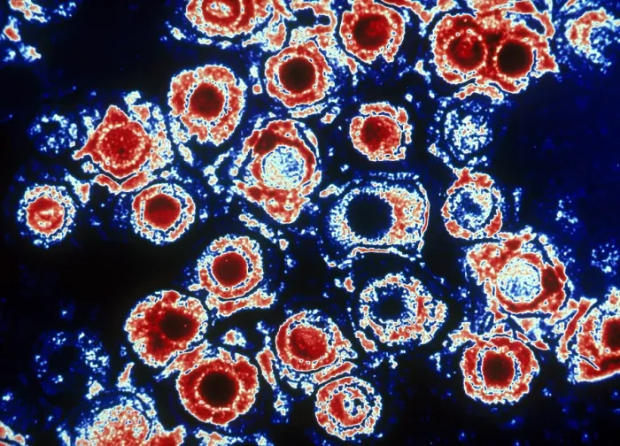 Framed Print : Herpes Simplex Virus (TEM) Framed Print : Herpes Simplex Virus (TEM)