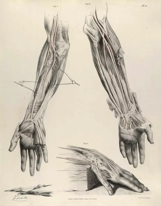 Framed Print : Historical Anatomical Illustration