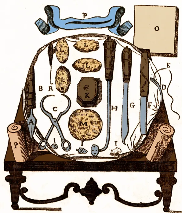 Framed Print : Historical Surgical Tools