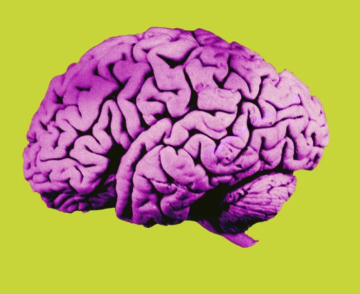 Framed Print : Human Brain Framed Print : Human Brain