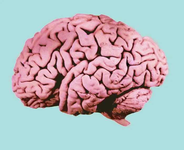 Framed Print : Human Brain Framed Print : Human Brain
