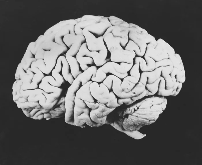 Framed Print : Human brain Framed Print : Human brain