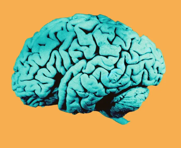 Framed Print : Human Brain Framed Print : Human Brain