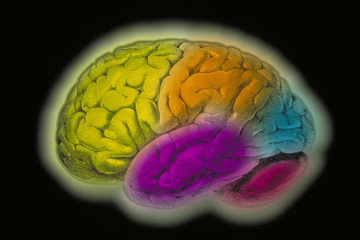Framed Print : Human brain Framed Print : Human brain