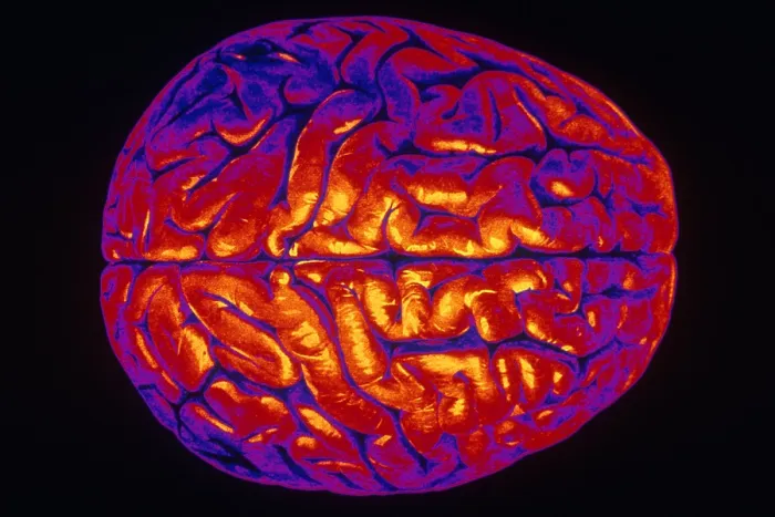 Framed Print : Human Brain Framed Print : Human Brain