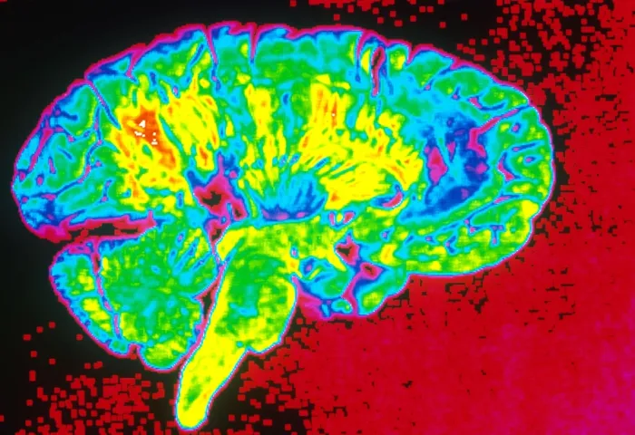 Framed Print : Human Brain Framed Print : Human Brain