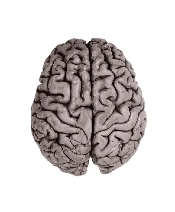 Framed Print : Human Brain, gross specimen Framed Print : Human Brain, gross specimen