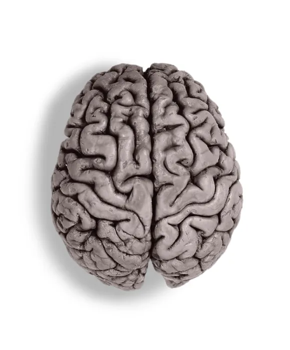 Framed Print : Human Brain, gross specimen Framed Print : Human Brain, gross specimen