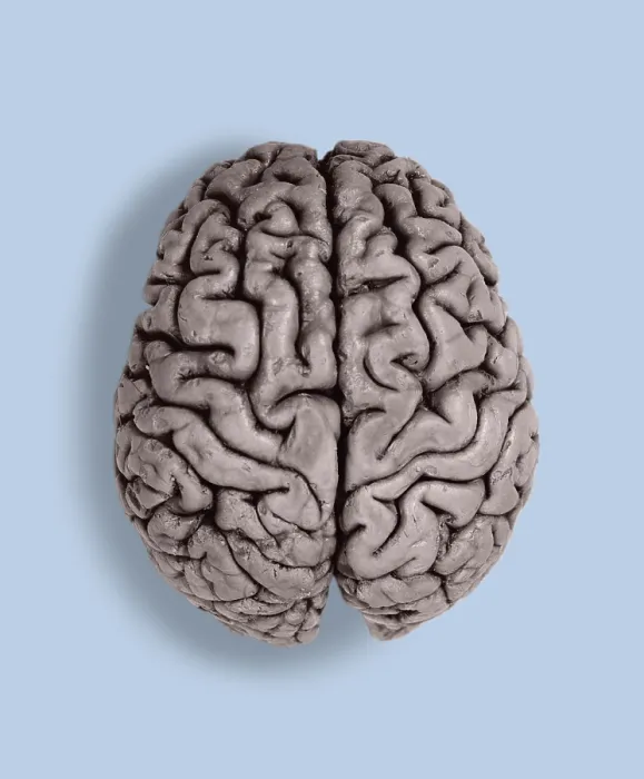 Framed Print : Human Brain, gross specimen Framed Print : Human Brain, gross specimen