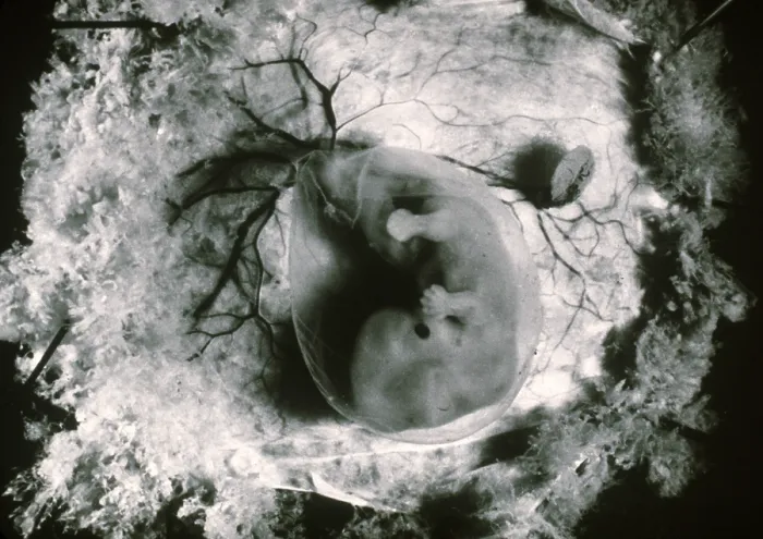 Framed Print : Human Embryo
