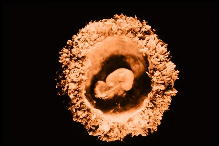 Framed Print : Human embryo Framed Print : Human embryo