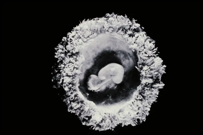 Framed Print : Human embryo Framed Print : Human embryo