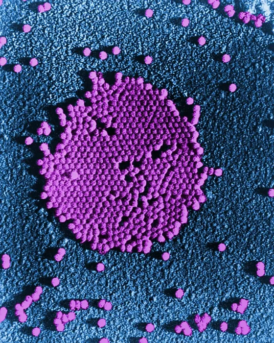 Framed Print : Human Enterovirus, Poliovirus, TEM Framed Print : Human Enterovirus, Poliovirus, TEM