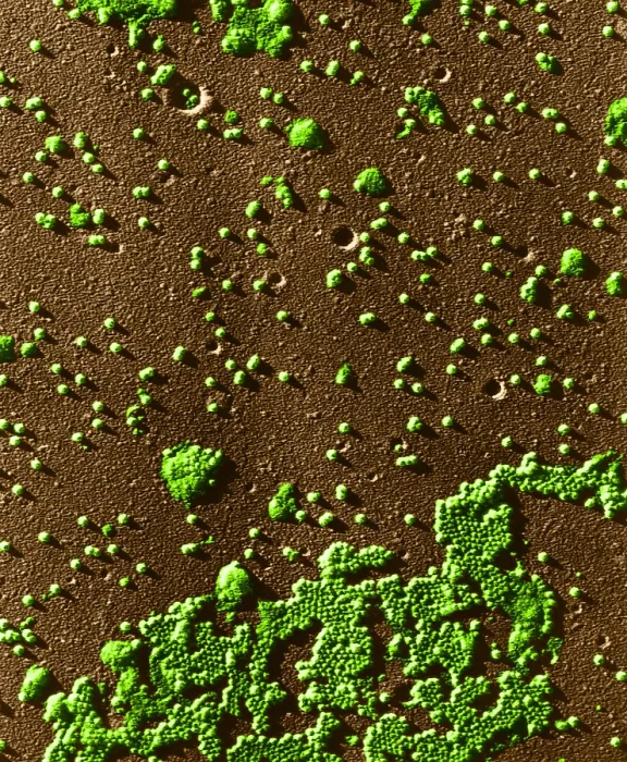 Framed Print : Human Enterovirus, Poliovirus, TEM Framed Print : Human Enterovirus, Poliovirus, TEM