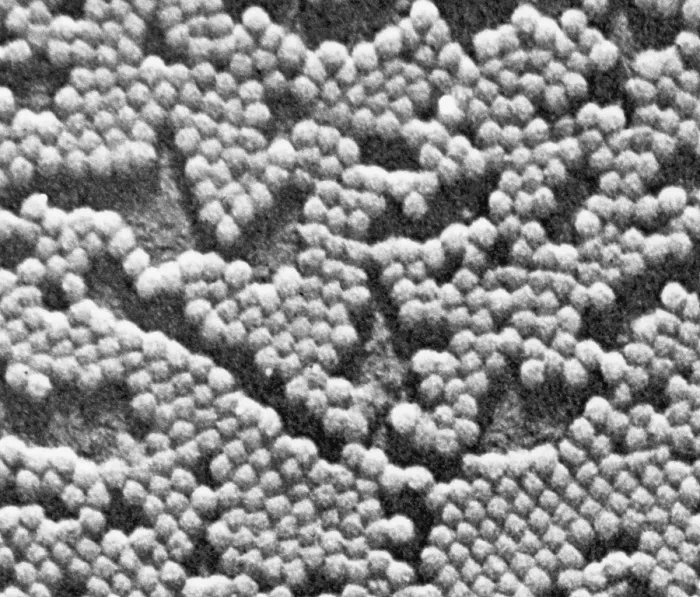 Framed Print : Human Enterovirus, Poliovirus, TEM Framed Print : Human Enterovirus, Poliovirus, TEM