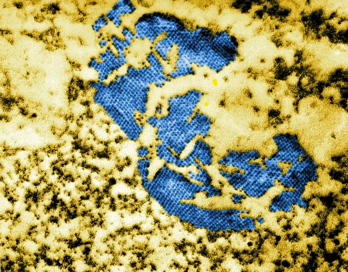 Framed Print : Human Enterovirus, Poliovirus, TEM