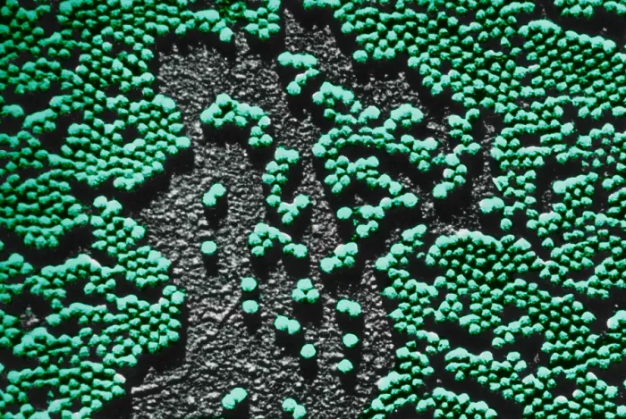 Framed Print : Human Enterovirus, Poliovirus, TEM Framed Print : Human Enterovirus, Poliovirus, TEM