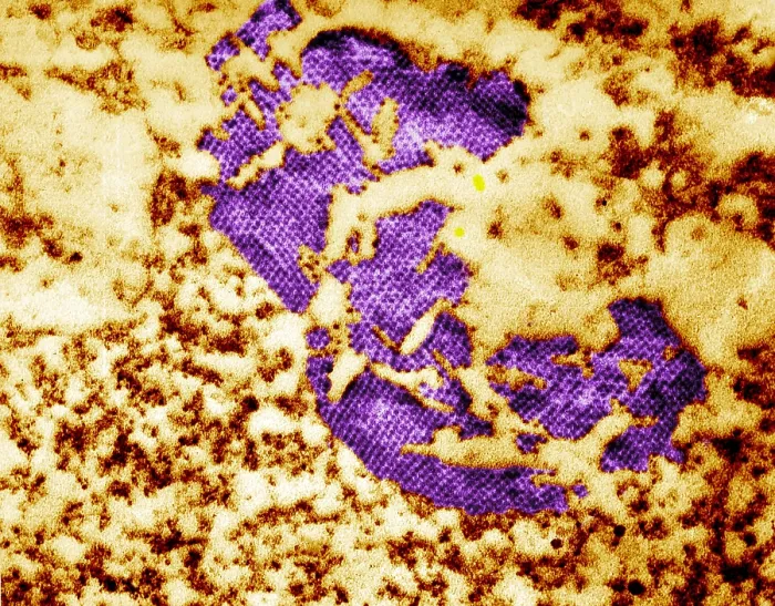 Framed Print : Human Enterovirus, Poliovirus, TEM Framed Print : Human Enterovirus, Poliovirus, TEM