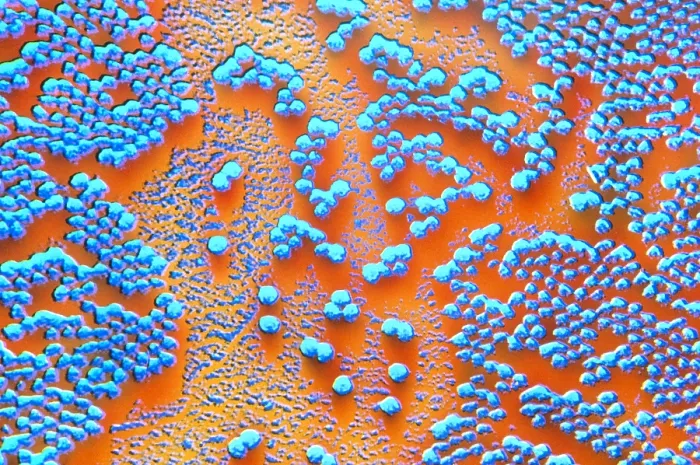 Framed Print : Human Enterovirus, Poliovirus, TEM Framed Print : Human Enterovirus, Poliovirus, TEM