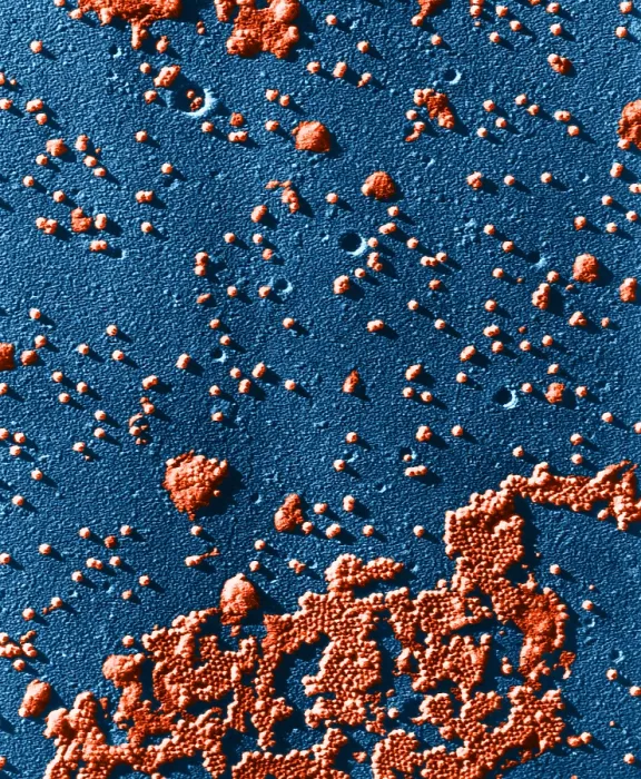 Framed Print : Human Enterovirus, Poliovirus, TEM Framed Print : Human Enterovirus, Poliovirus, TEM
