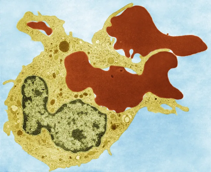 Framed Print : Human Phagocyte, Phagocytosis, TEM Framed Print : Human Phagocyte, Phagocytosis, TEM