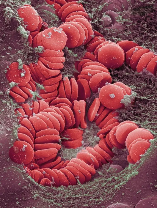 Framed Print : Human Red Blood Cells, under a microscope (SEM)