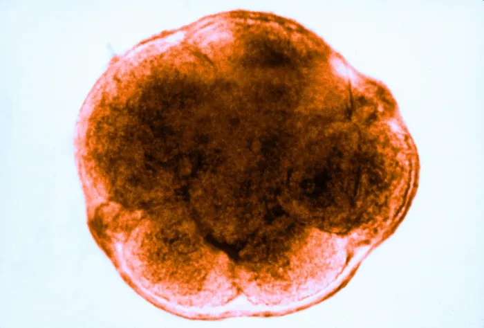 Framed Print : Human Reproduction, Ovum, 8-Cell Stage, light micrograph Framed Print : Human Reproduction, Ovum, 8-Cell Stage, light micrograph