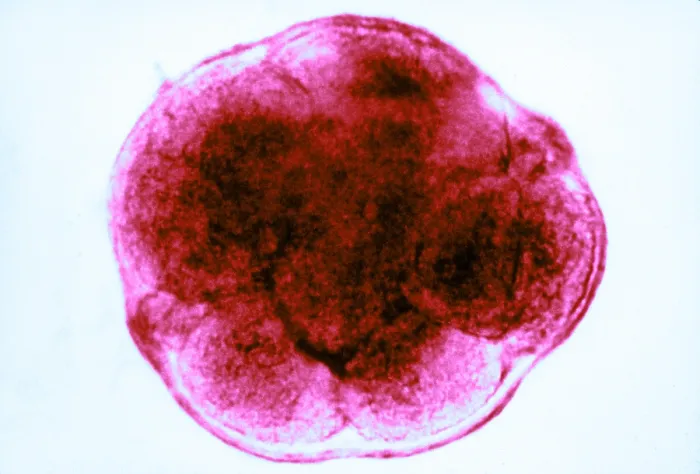 Framed Print : Human Reproduction, Ovum, 8-Cell Stage, light micrograph Framed Print : Human Reproduction, Ovum, 8-Cell Stage, light micrograph