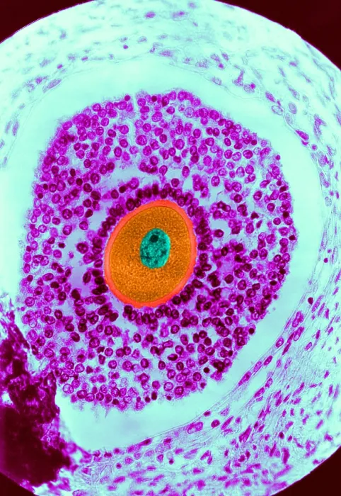 Framed Print : Human Reproduction, Ovum, light micrograph Framed Print : Human Reproduction, Ovum, light micrograph