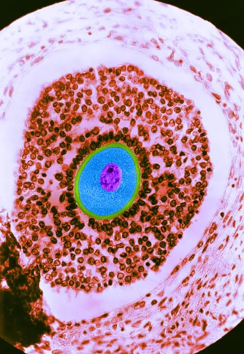 Framed Print : Human Reproduction, Ovum, light micrograph